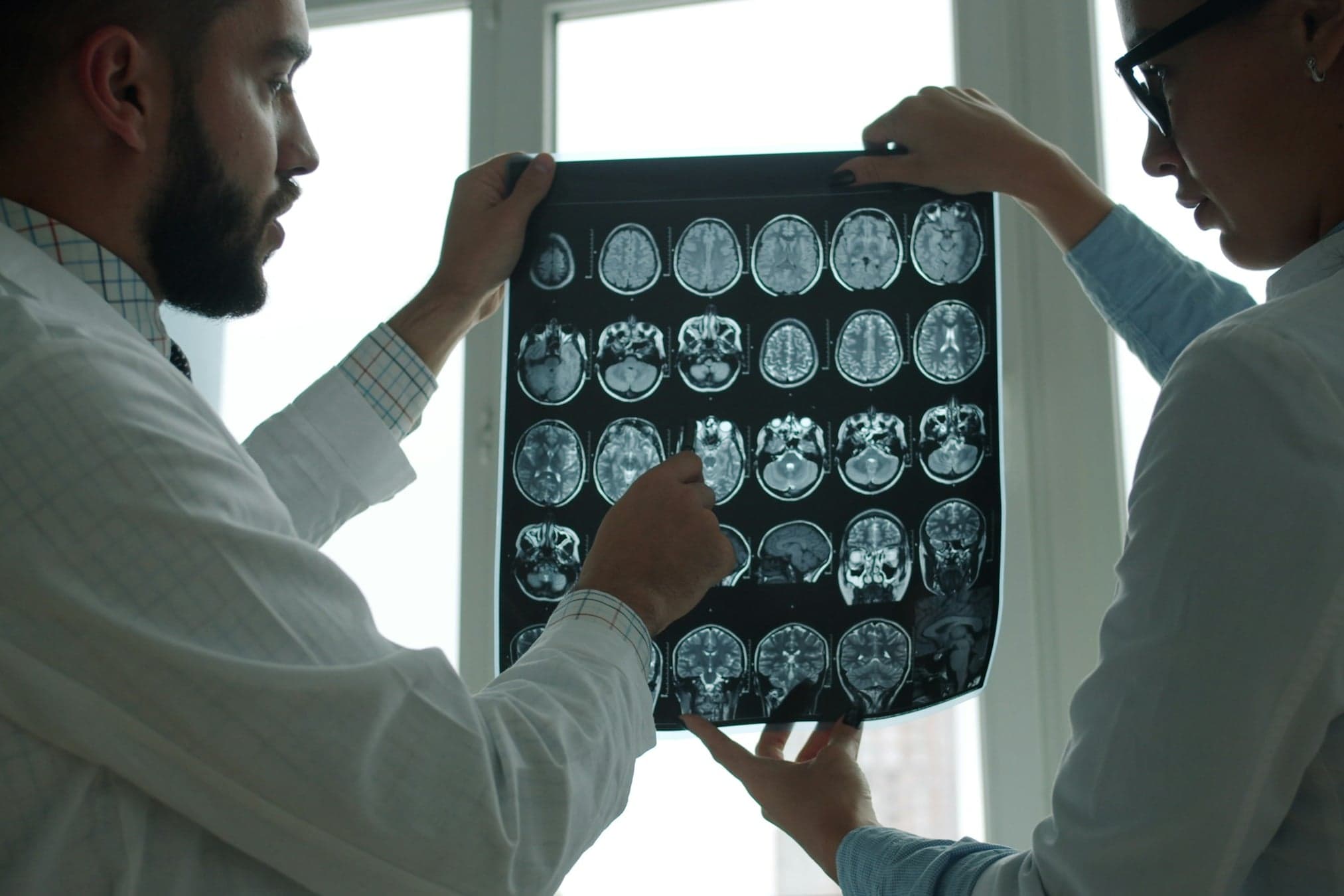 Two doctors reviewing a brain MRI film against a window